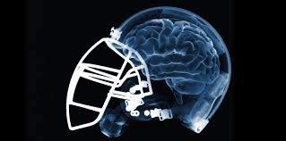National Football League concussion ruling begins discussion